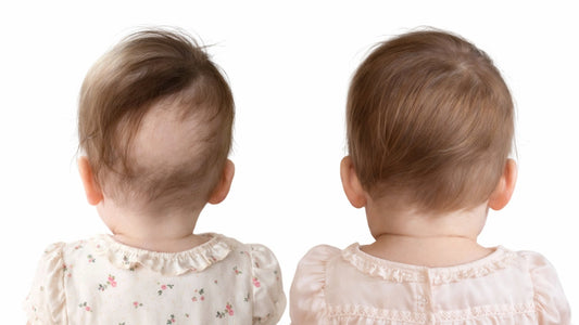The “Back-to-Sleep” Bald Spot: Is Your Mattress Fabric Sabotaging Your Baby’s Hair?